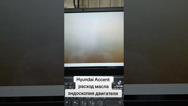 Hyundai Accent 1.6 жалоба на расход масла, видео эндоскопия двигателя! #расходмасла #масложор