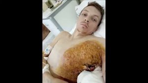 История не для слабонервных. Применение ХемоХим при лечении онкологии😱😱