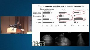 УЗИ легких при пневмониях. Новиков В.А 2017