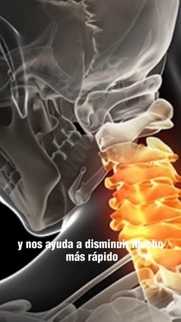 Láser de Alta Intensidad #fisioterapia смотреть онлайн