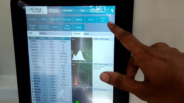 Erba Transasia H360 Analyser - CBC Software - Smart Lab (LIS) - Tamil - Ekoders Software