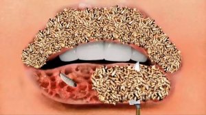 ASMR Remove Worm Trojan Infected & Lips Tartar | ASMR 2d Animation Treatment||@BrekASMR