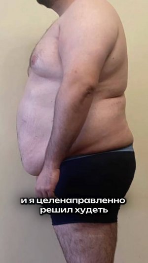История похудения моего пациента! 1,5 года назад я выполнил ему липосакцию талии и спины!