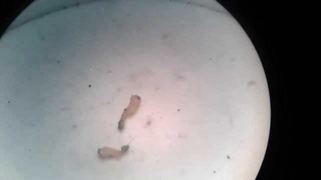 Pupa Lutzomyia longipalpis смотреть онлайн