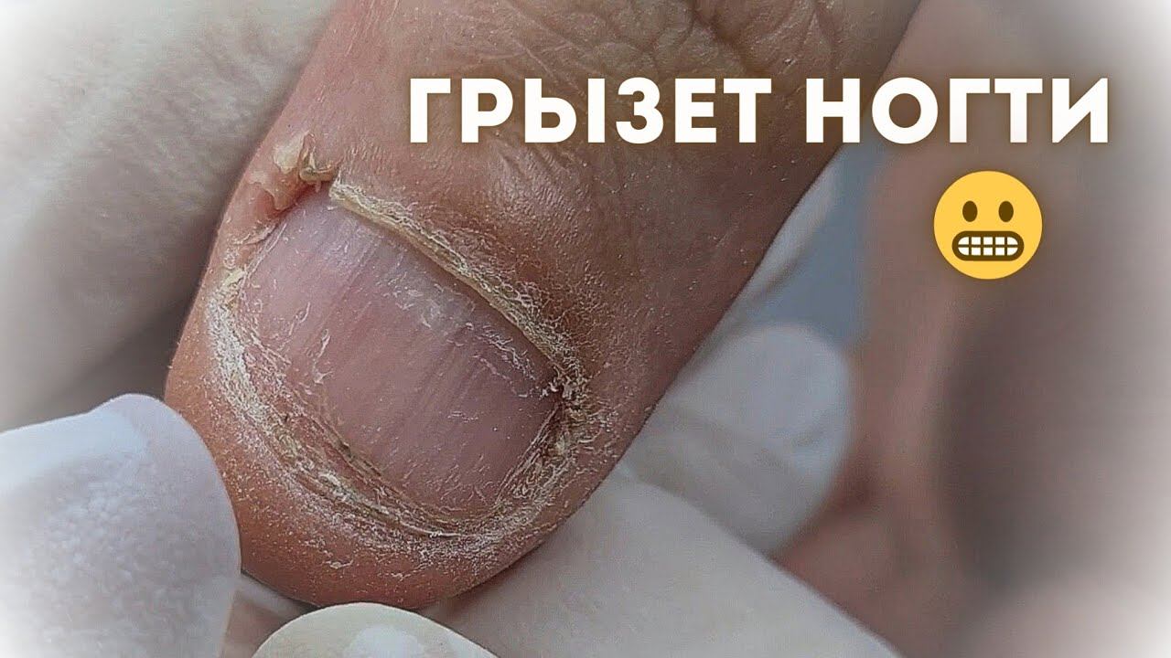 Стала у него первой НОГТИ ГРЫЗУНА ПРЕОБРАЖЕНИЕ ЧАСТЬ 1, мужской маникюр с полировкой ногтей. смотреть онлайн