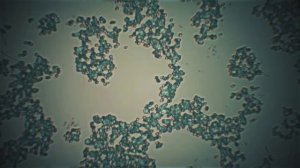 Докуметальный фильм Иммунитет. Идеальный телохранитель (тизер)