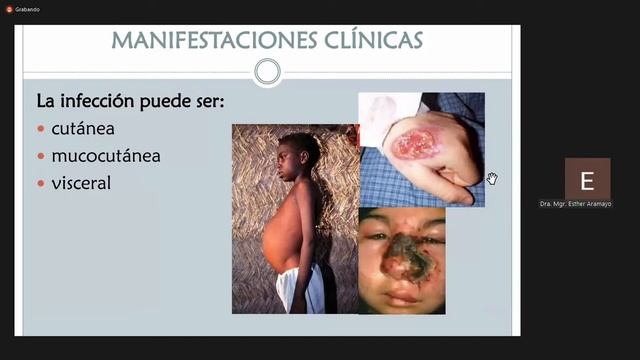 LAISHMANIASIS 2021 05 15 смотреть онлайн