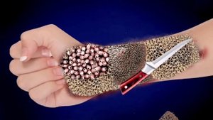 ASMR Animation Treatment Infected Back Side,, Treatment Collection 🤧 || Deep Cleaning ASMR Animatio