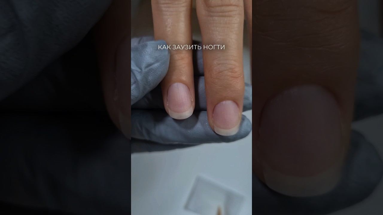 Заузить ногти, поджатие ногтей. Укрепление ногтей #ногти #маникюр #укреплениеногтей #укреплениегелем смотреть онлайн