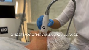 ЭНДЕРМОЛОГИЯ ЛИЦА LPG ALLIANCE