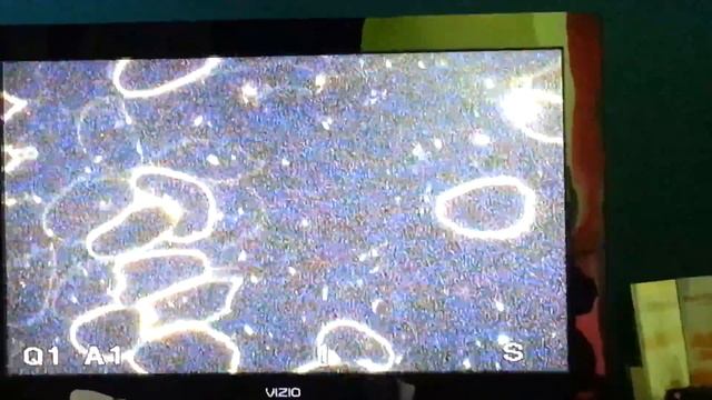 BP's darkfield microscopy смотреть онлайн