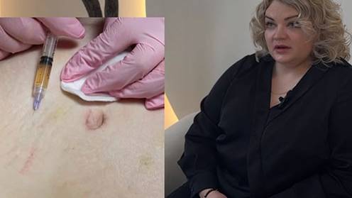 Видеоинструкция техники работы с рубцами смотреть онлайн