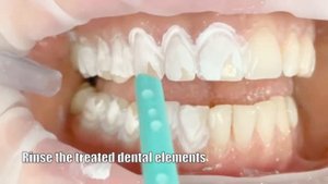 Dentin Desensitizer Application (English)