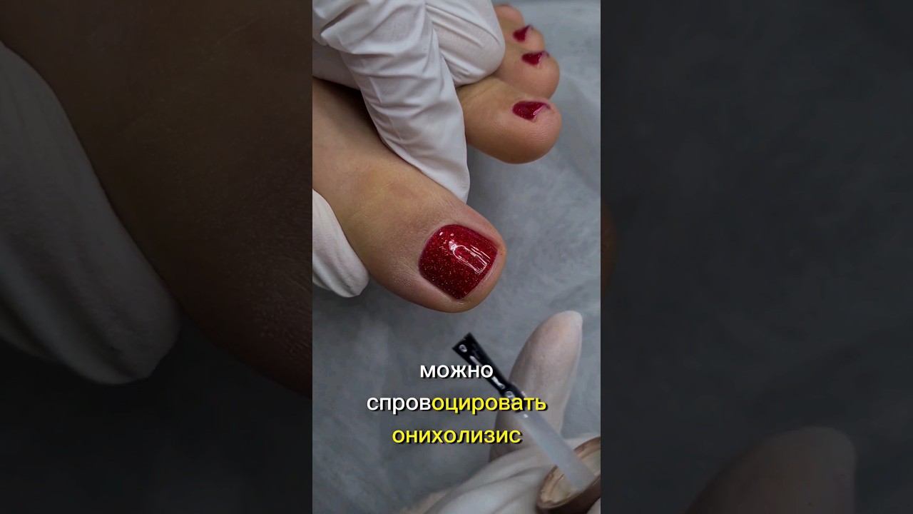Вред гель-лака в педикюре #гельлак #shorts #ногти #nails #онихолизис #врастаниеногтей смотреть онлайн