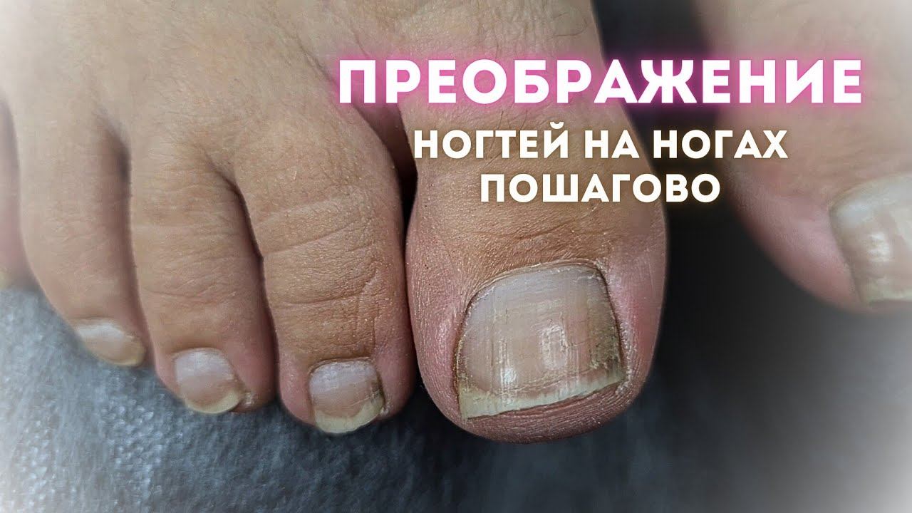 Чем заменить гель-лак на ногтях? Педикюр подробно пошагово. Плёнки для педикюра смотреть онлайн