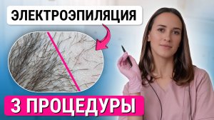 Как УСКОРИТЬ курс процедур электроэпиляции и быстро удалить волосы?