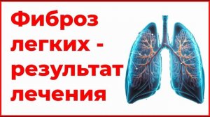 Фиброз легких результат лечения Анонс в ютуб