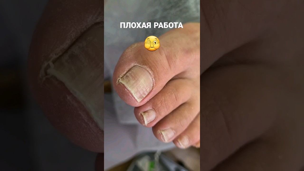 Что с ногтями? #shorts #nails #педикюр #pedicure #покрытиепростымлаком #обычныйлак смотреть онлайн