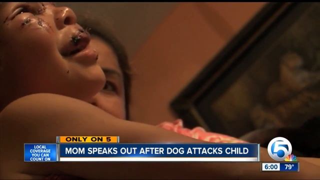 5-year-old girl bitten by neighbor's dog, family pet pitbull helped save her from the attack смотреть онлайн