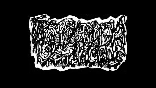 Fibrodysplasia - Chronic Amputation promo смотреть онлайн