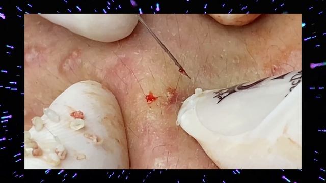 Глубокая чистка лица профессиональным косметологом
