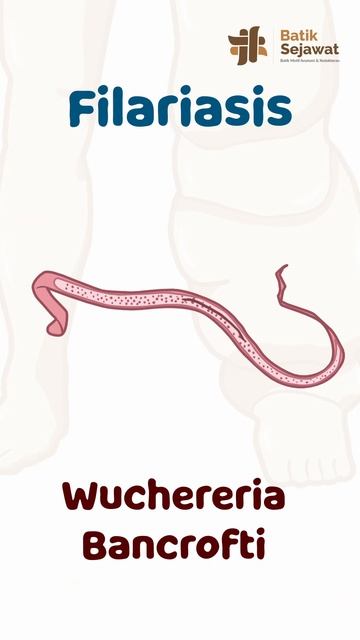 Apa itu filariasis? Cacingan? смотреть онлайн