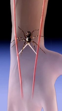 How spider bite affect your body | 3D animation #shorts #youtubeshorts