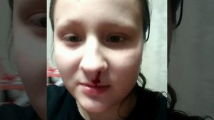 Да да да да да да да да да я обьлше не боюсь крови, поздравьте меня