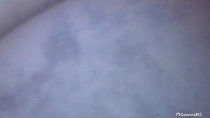 ✅️ Skoda Superb 1.8T 2018 178000км: эндоскопия катализатора