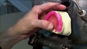 Как изготавливают зубные протезы