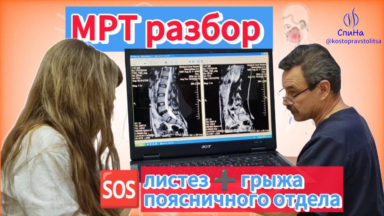 МРТ разбор, грыжа поясничного отдела #костоправмосква #спина #здоровьеспины #больвспине #чтоделать