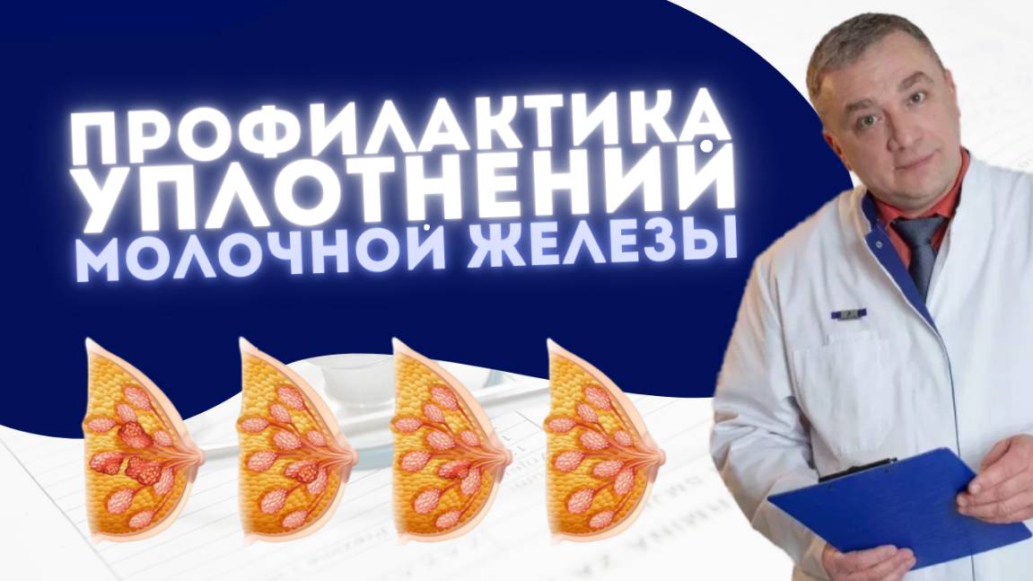 ПРОФИЛАКТИКА УПЛОТНЕНИЙ МОЛОЧНОЙ ЖЕЛЕЗЫ