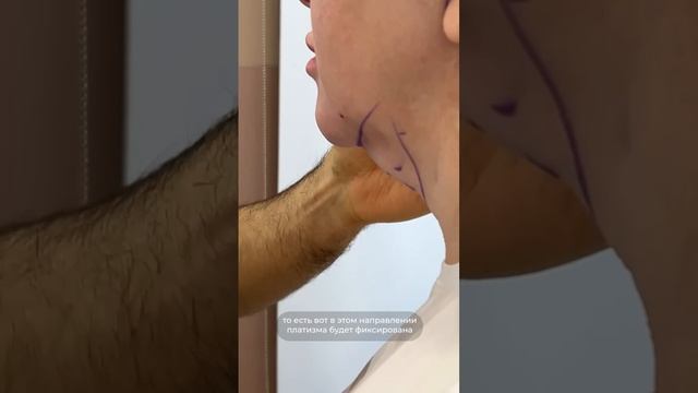 СМАС-ПОДТЯЖКА ЛИЦА И ШЕИ. Доктор Карапетян