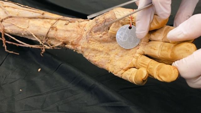 Arm dran? Anatomie der oberen Extremität | Sezierkurs Live Anatomie Innsbruck смотреть онлайн
