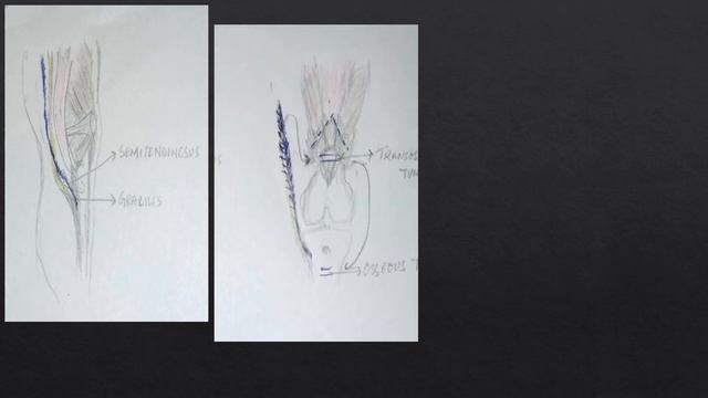 CASE – TRAUMATIC PATELLA TENDON TEAR video смотреть онлайн