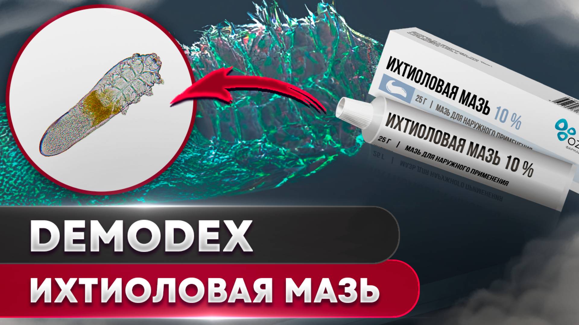 Ихтиоловая мазь против клеща | Угревая Железница Demodex смотреть онлайн