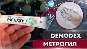 Метрогил против клеща | Угревая Железница Demodex # 1