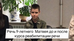 Заикание в 9 лет. Речь Матвея до и после курса Татьяны Соловьевой