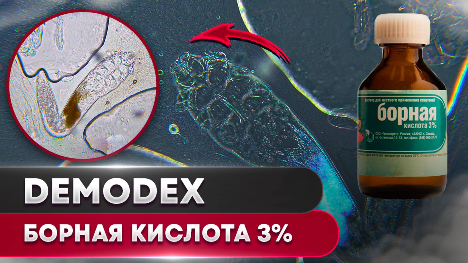 Борная Кислота 3% против клеща | Угревая Железница Demodex смотреть онлайн