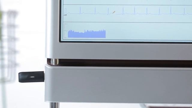 Health-Expess (HeartVUE).  Measurement of ECG microalternations and analysis by dispersion mapping