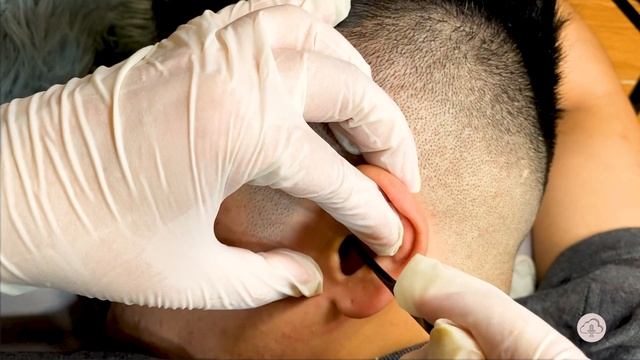 ASMR Worlds’s Greatest ear cleaning/Exam Ear Massage pt.2(No Talking)