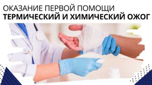 Оказание первой помощи. Термический и химический ожог
