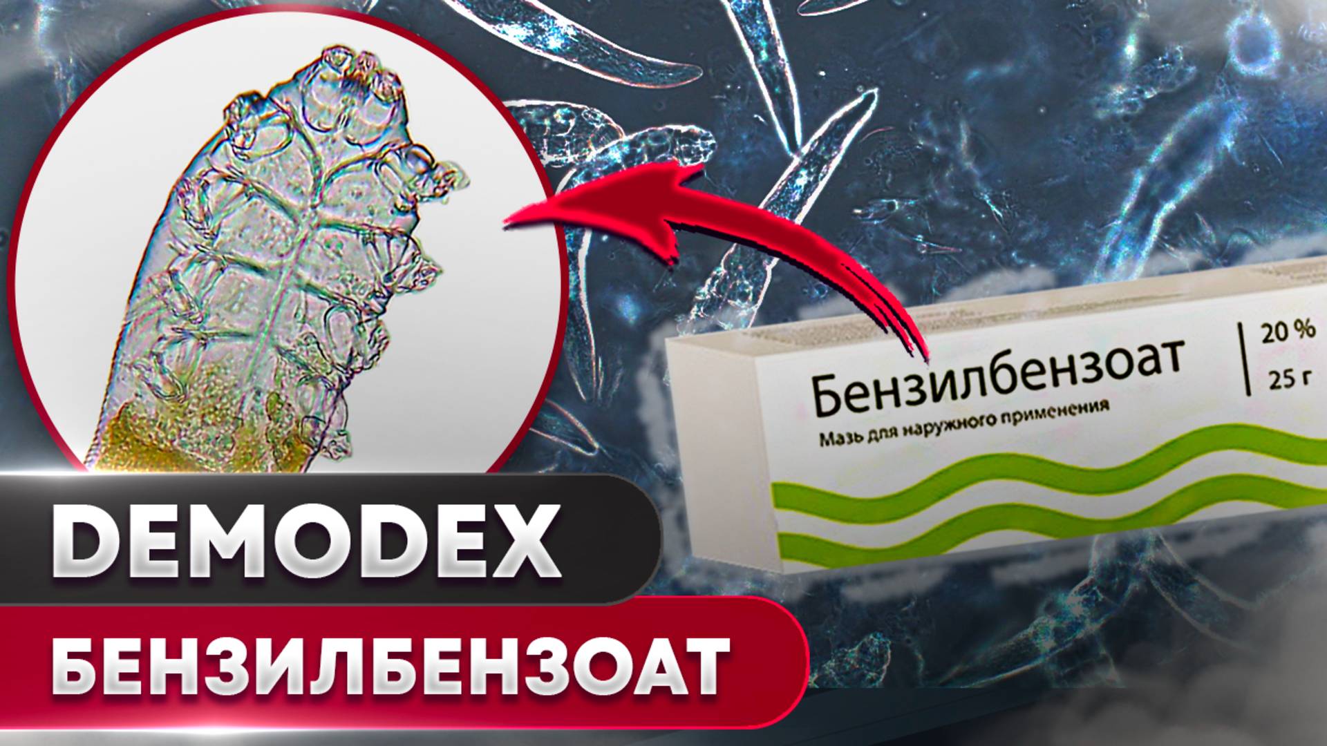 Бензилбензоат против клеща | Угревая Железница Demodex смотреть онлайн