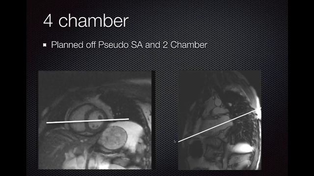 MRI Imaging Planes