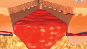 Замучили трещины на пятках?Вы забудете об этой проблеме раз и навсегда-ЧИТАТЬ В ОПИСАНИЕ!