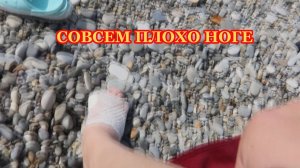 VLOG :СОВСЕМ ПЛОХО НОГЕ\ПОСЛЕДНИЙ ДЕНЬ НА МОРЕ