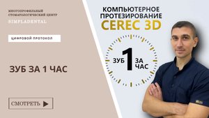 Зуб за 1 час