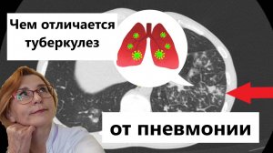 Пневмония и туберкулез