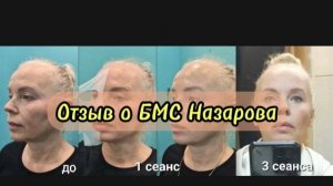 Отзыв Светланы о пройденных процедурах коррекции лица аппаратом Назарова.