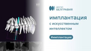 🦷 Имплантация с Искусственным интеллектом